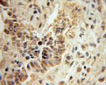 Mecr Antibody in Immunohistochemistry (Paraffin) (IHC (P))