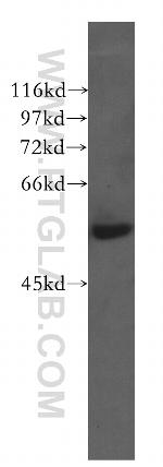 CTRP6 Antibody in Western Blot (WB)