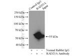RAD23A Antibody in Immunoprecipitation (IP)
