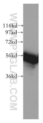 RAD23A Antibody in Western Blot (WB)