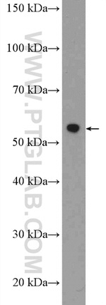 RAD23A Antibody in Western Blot (WB)