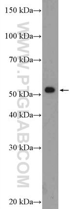 RAD23A Antibody in Western Blot (WB)