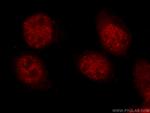 HSF1 Antibody in Immunocytochemistry (ICC/IF)