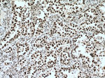 HSF1 Antibody in Immunohistochemistry (Paraffin) (IHC (P))