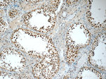 HSF1 Antibody in Immunohistochemistry (Paraffin) (IHC (P))