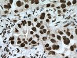HSF1 Antibody in Immunohistochemistry (Paraffin) (IHC (P))