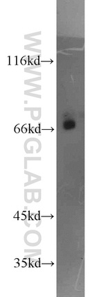HSF1 Antibody in Western Blot (WB)