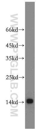 Fabp4 Antibody in Western Blot (WB)