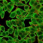 Th-Pok/ZBTB7B Monoclonal Antibody (PCRP-ZBTB7B-1B6)