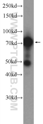 Cd2ap Antibody in Western Blot (WB)