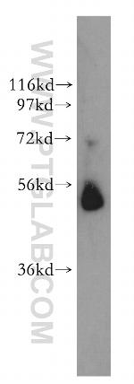 Galc Antibody in Western Blot (WB)