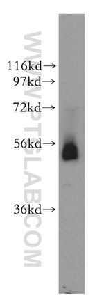 Galc Antibody in Western Blot (WB)