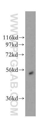 Galc Antibody in Western Blot (WB)