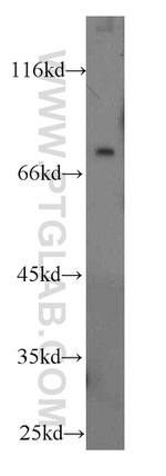 Galc Antibody in Western Blot (WB)