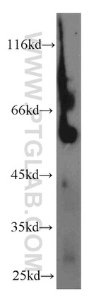 Galc Antibody in Western Blot (WB)