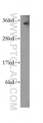 PNRC1 Antibody in Western Blot (WB)