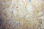 PHF6 Antibody in Immunohistochemistry (Paraffin) (IHC (P))