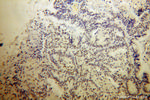 PHF6 Antibody in Immunohistochemistry (Paraffin) (IHC (P))