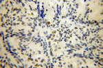 PHF6 Antibody in Immunohistochemistry (Paraffin) (IHC (P))
