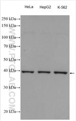 PHF6 Antibody in Western Blot (WB)