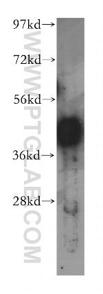PHF6 Antibody in Western Blot (WB)