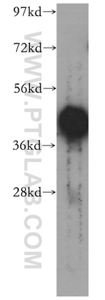 PHF6 Antibody in Western Blot (WB)