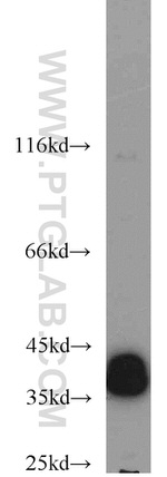 ERK1/2 Antibody in Western Blot (WB)