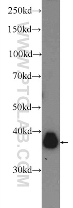 ERK1/2 Antibody in Western Blot (WB)