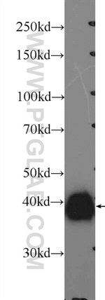 ERK1/2 Antibody in Western Blot (WB)