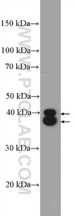 ERK1/2 Antibody in Western Blot (WB)