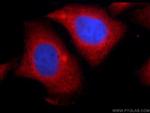 ERK1/2 Antibody in Immunocytochemistry (ICC/IF)