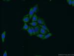 STAT4 Antibody in Immunocytochemistry (ICC/IF)