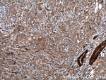 STAT4 Antibody in Immunohistochemistry (Paraffin) (IHC (P))