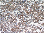STAT4 Antibody in Immunohistochemistry (Paraffin) (IHC (P))