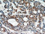 STAT4 Antibody in Immunohistochemistry (Paraffin) (IHC (P))