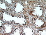STAT4 Antibody in Immunohistochemistry (Paraffin) (IHC (P))