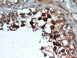 STAT4 Antibody in Immunohistochemistry (Paraffin) (IHC (P))