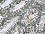 STAT4 Antibody in Immunohistochemistry (Paraffin) (IHC (P))