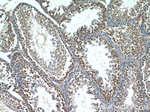 STAT4 Antibody in Immunohistochemistry (Paraffin) (IHC (P))