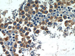 STAT4 Antibody in Immunohistochemistry (Paraffin) (IHC (P))