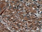 STAT4 Antibody in Immunohistochemistry (Paraffin) (IHC (P))