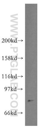 STAT4 Antibody in Western Blot (WB)