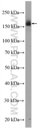 EGFR (C-terminal) Antibody in Western Blot (WB)