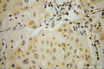 STAT5A Antibody in Immunohistochemistry (Paraffin) (IHC (P))