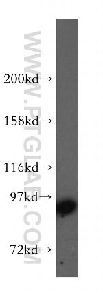 STAT5A Antibody in Western Blot (WB)