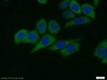 AKT1 Antibody in Immunocytochemistry (ICC/IF)