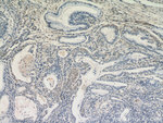 AKT1 Antibody in Immunohistochemistry (Paraffin) (IHC (P))