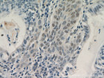 AKT1 Antibody in Immunohistochemistry (Paraffin) (IHC (P))
