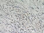 AKT1 Antibody in Immunohistochemistry (Paraffin) (IHC (P))