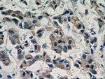 AKT1 Antibody in Immunohistochemistry (Paraffin) (IHC (P))